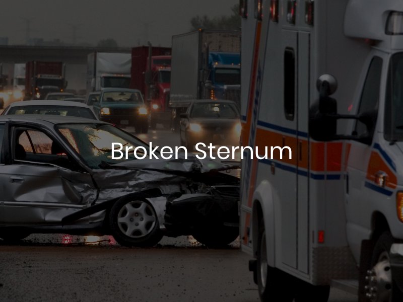 Driver with a broken sternum after a car accident