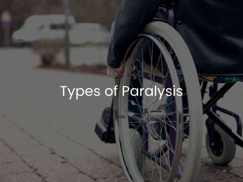 Types of Paralysis 
