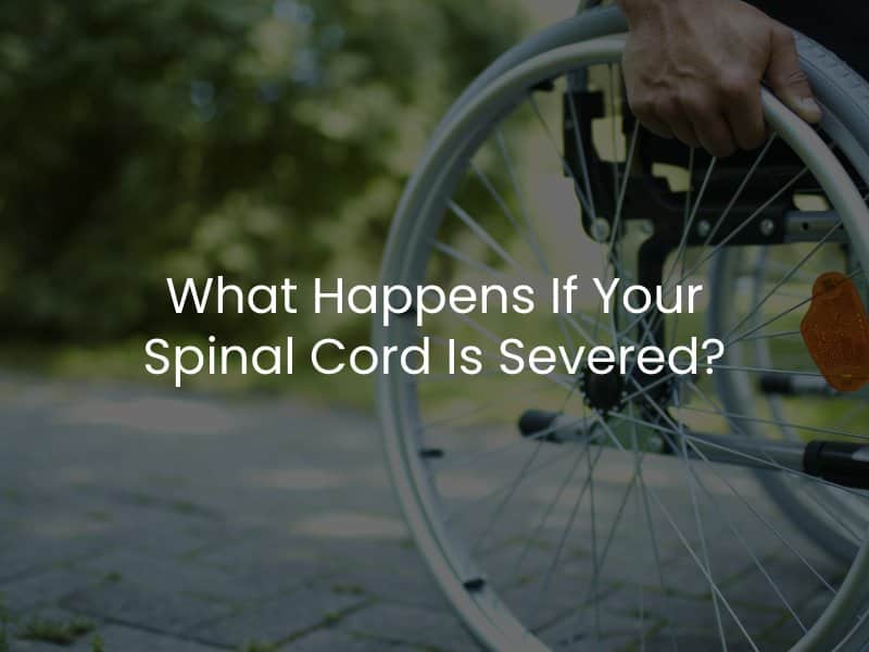 What Happens If Your Spinal Cord Is Severed?
