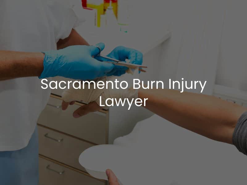 Sacramento Burn Injury Lawyer