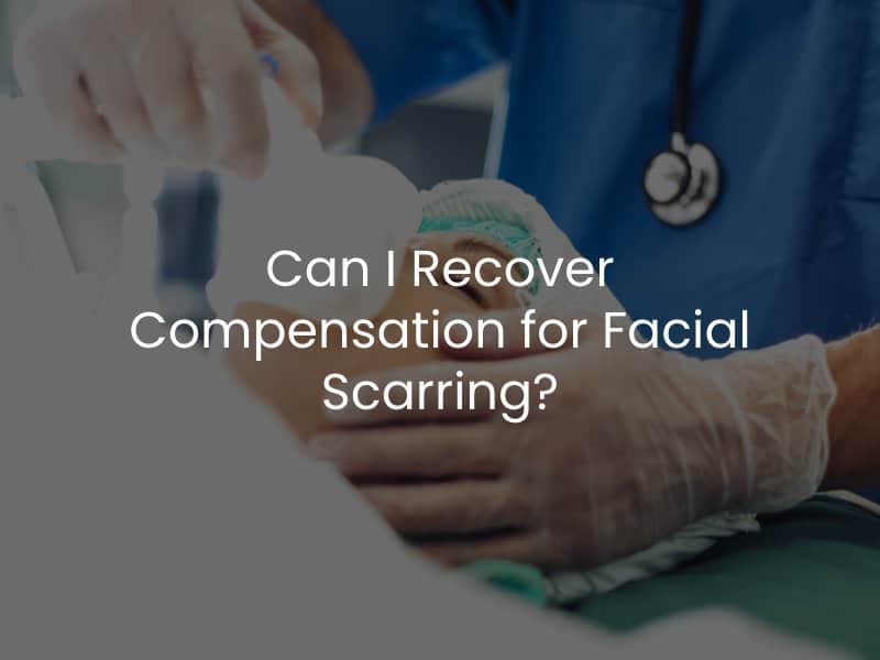 Can I Recover Compensation for Facial Scarring?